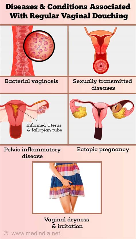 Vaginal Douching Is It Really Beneficial