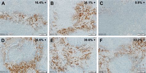 Figure 1 From Overcoming Tumor Hypoxia As A Barrier To Radiotherapy