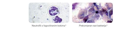 Malassezia Dermatitis