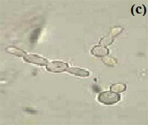 Effect Of Growth Media Ph And Temperature On Yeast To Hyphal Transition In Candida Albicans