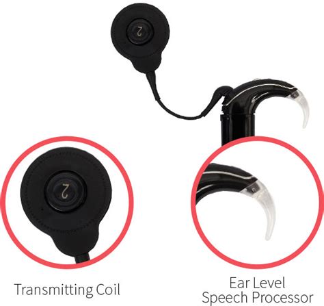 How Does Cochlear Implant Work? - My Baby's Hearing