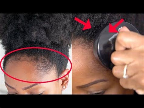 How To CARE FOR And GROW BACK Your EDGES In 3 EASY PRACTICAL STEPS