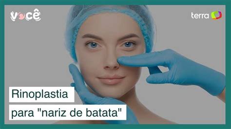 Rinoplastia Uma Boa Solu O Para O Nariz De Batata