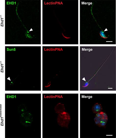 Frontiers A Missense Mutation In Ehd1 Associated With Defective