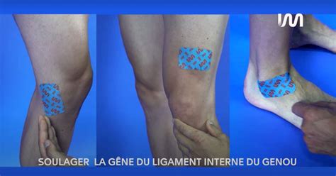 Soulager La Gêne Du Ligament Latéral Interne Du Genou Stimcare