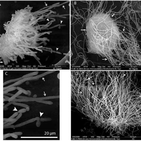 Scanning Electron Micrographs Of Candida Albicans Clinical Strains