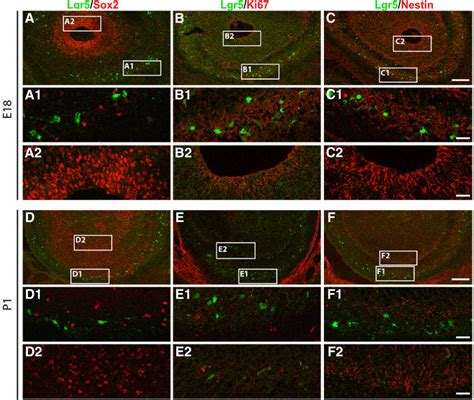 Lgr Does Not Mark Stem Cells In The Ob At Prenatal And Neonatal