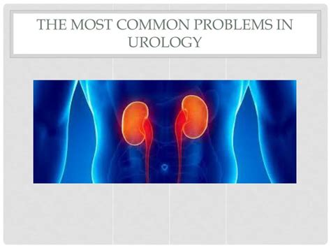 Ppt The Most Common Problems In Urology Powerpoint Presentation Free