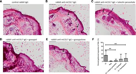 Frontiers Luteolin Peracetate And Gossypolone Inhibit Immune Complex