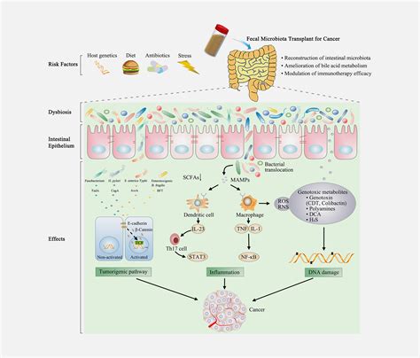 Fecal Microbiota Transplantation In Cancer Management Current Status