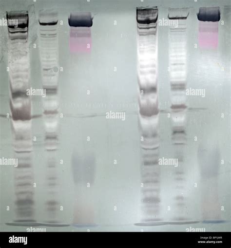 Western blot membrane - showing protein profiles of 4 samples and a molecular weight ladder ...