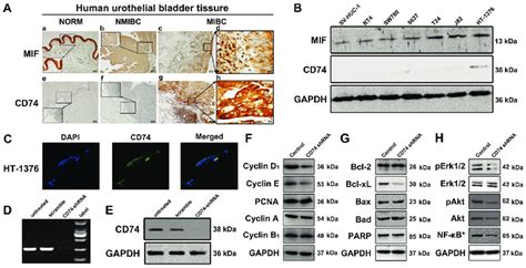 Expression Of Mif And Cd74 In Tissue Samples And Cells And Protein