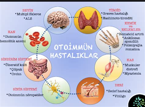 Otoimm Nite Otoantikor Ve Hastal Klar Le Li Kileri Genetik