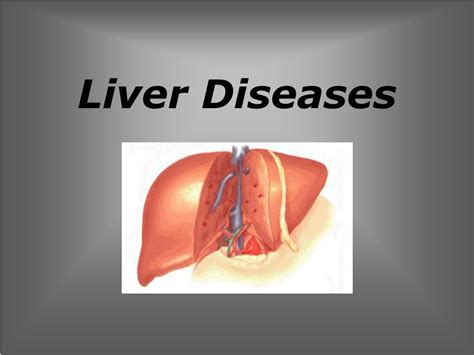 Ppt Liver Diseases Powerpoint Presentation Free Download Id5501166