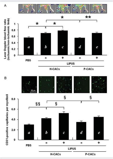 Figure From Ultrasound Stimulation Restores Impaired