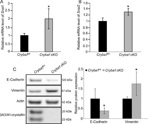 Cryba1 Is Involved In The Onset Of Emt In The Mouse Rpe Cells A B Download Scientific