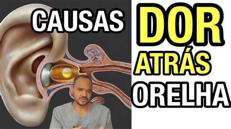 DOR ATRÁS DA ORELHA: 4 CAUSAS NEUROLÓGICAS - YouTube