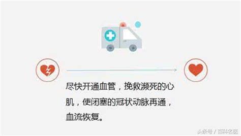 急性心肌梗死前的徵兆你有嗎？就是心肌，時間就是生命」！怎樣處理可以救回一命？ 每日頭條