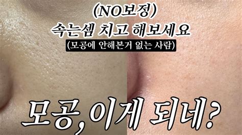 모공 관리 안하면 나처럼 늘어짐피부과no 홈케어 관리 시작해보자고요절대 하지말아야할 모공커지는 습관구독자 이벤트 있음