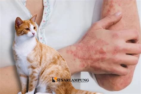 Waspada Penyakit Kulit Dari Kucing Dapat Menular Kepada Manusia