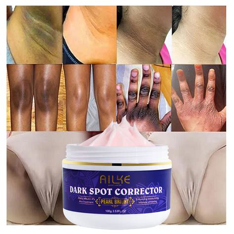 Private Label Niacinamide Dark Knees Knuckles Elbows Armpit Whitening ...