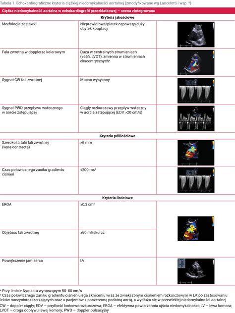 Kardiologia Po Dyplomie Bezobjawowa Niedomykalno Zastawki Aortalnej