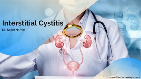 Ppt A Comprehensive Guide To Interstitial Cystitis Powerpoint Presentation Id 12258309