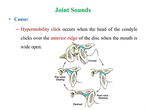 Contemporary Management Of Temporomandibular Diso 2