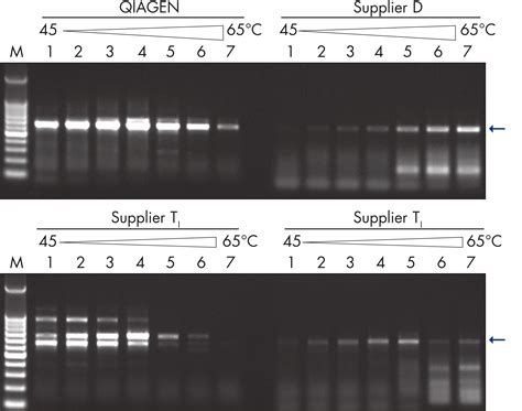 Qiagen Onestep Rt Pcr Kit