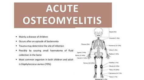 Acute Osteomyelitis Pptpptx