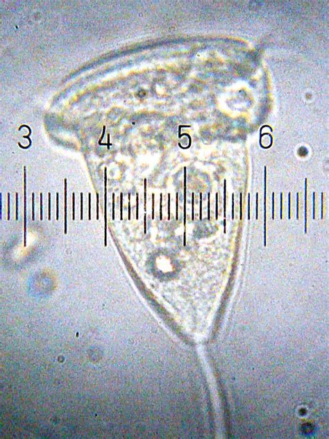 Vorticella - microbewiki