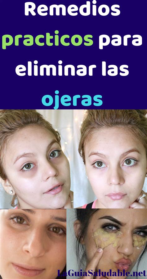 C Mo Eliminar Las Ojeras De Forma Natural Las Ojeras Esas Molestas