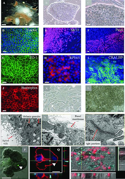 Hesc Derived Pigmented Cells Are Putative Rpe Cells A Dark Field