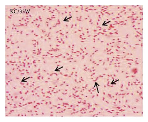 Coccobacillus Shape