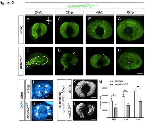 Figure 3 From Developmental Delay During Eye Morphogenesis Underlies