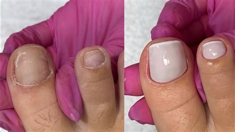 Cutilagem E Esmaltação Das Unhas Dos Pés 🤩 Youtube