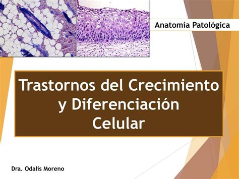 Trastornos del Crecimiento y Diferenciación Anatomía Patológica