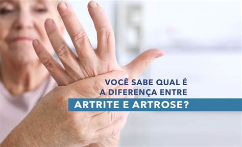 Artrite X Artrose Saiba A Diferen A Entre As Doen As Seus Sintomas