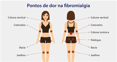 Entenda Um Pouco Melhor O Que Fibromialgia