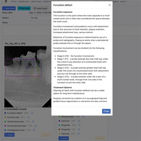 David X Ray Ai Dental Pathology Detection