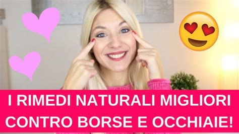 Arrossato Occhi Scopri 7 Rimedi Naturali Per Lenire Il Contorno 2024