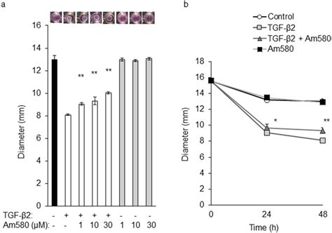 Inhibitory effect of an RAR α agonist on RPE cell mediated collagen gel