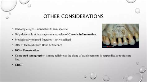 Vertical Root Fractures Ppt