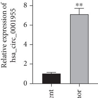 Hsa Circ 0001955 Was Upregulated In The CRC Tissues And CRC Cells A