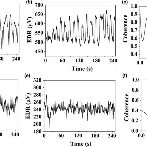 A A Portion Of The Rr Interval Time Series Of A Yogic Subject B