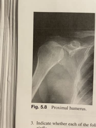 132 Ch 5 Review Excercise B Positioning Of The Humerus And Shoulder