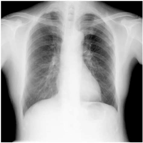 Dynamic Digital Radiography | KONICA MINOLTA