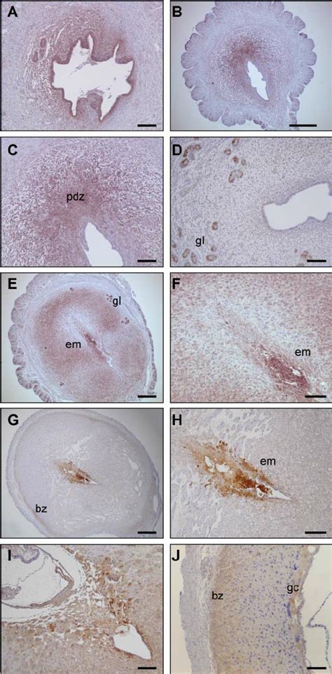 Immunohistochemical Localization Of Activin B A In Mouse Uterus During