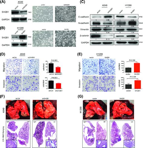 SH2B1 Alters EMT Markers And Induces The EMT Phenotypes Of LADC Cells