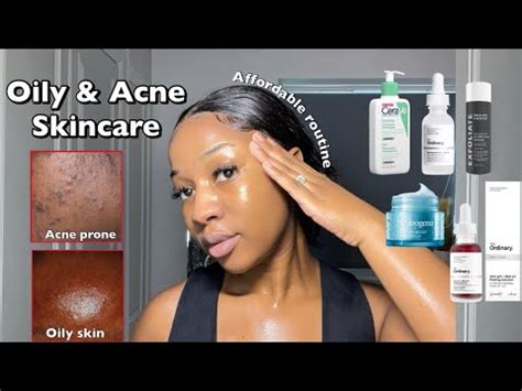 Best Acne Skincare Beauty Tips - Acne Beauty Skin